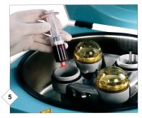 ACP preparation in centrifuge